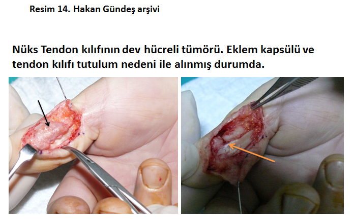 tendon-kilifi